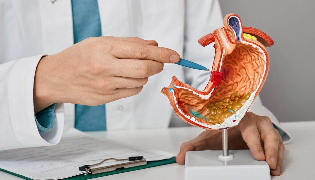 Proctologist vs. Gastroenterologist Holding a Model of a Stomach