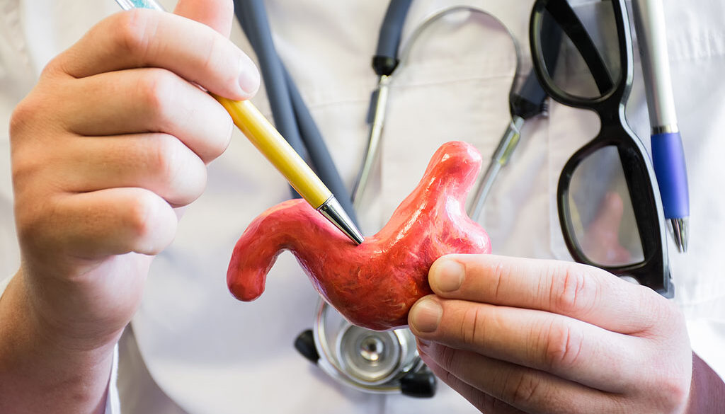 Closeup Of A Gastroenterologist Holding An Anatomical Model Of A Stomach Pointing To A Spot With A Pen Gastric Ulcers And Cancer