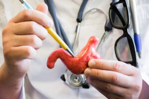 Closeup Of A Gastroenterologist Holding An Anatomical Model Of A Stomach Pointing To A Spot With A Pen Gastric Ulcers And Cancer