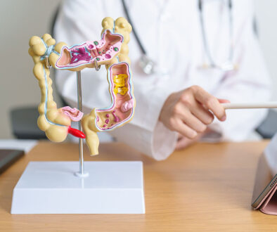 Closeup Of An Anatomical Model Of A Colon On A Desk With A Gastroenterologist Pointing At A Tablet Can Ulcerative Colitis Be Cured